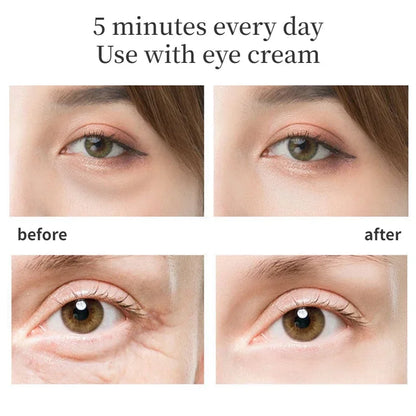 42 °Eye Beauty Device EMS Microcurrent Fade Black Circle Anti Wrinkle Beauty Anti Wrinkle Remove  Eye Lifting Vibration Massage