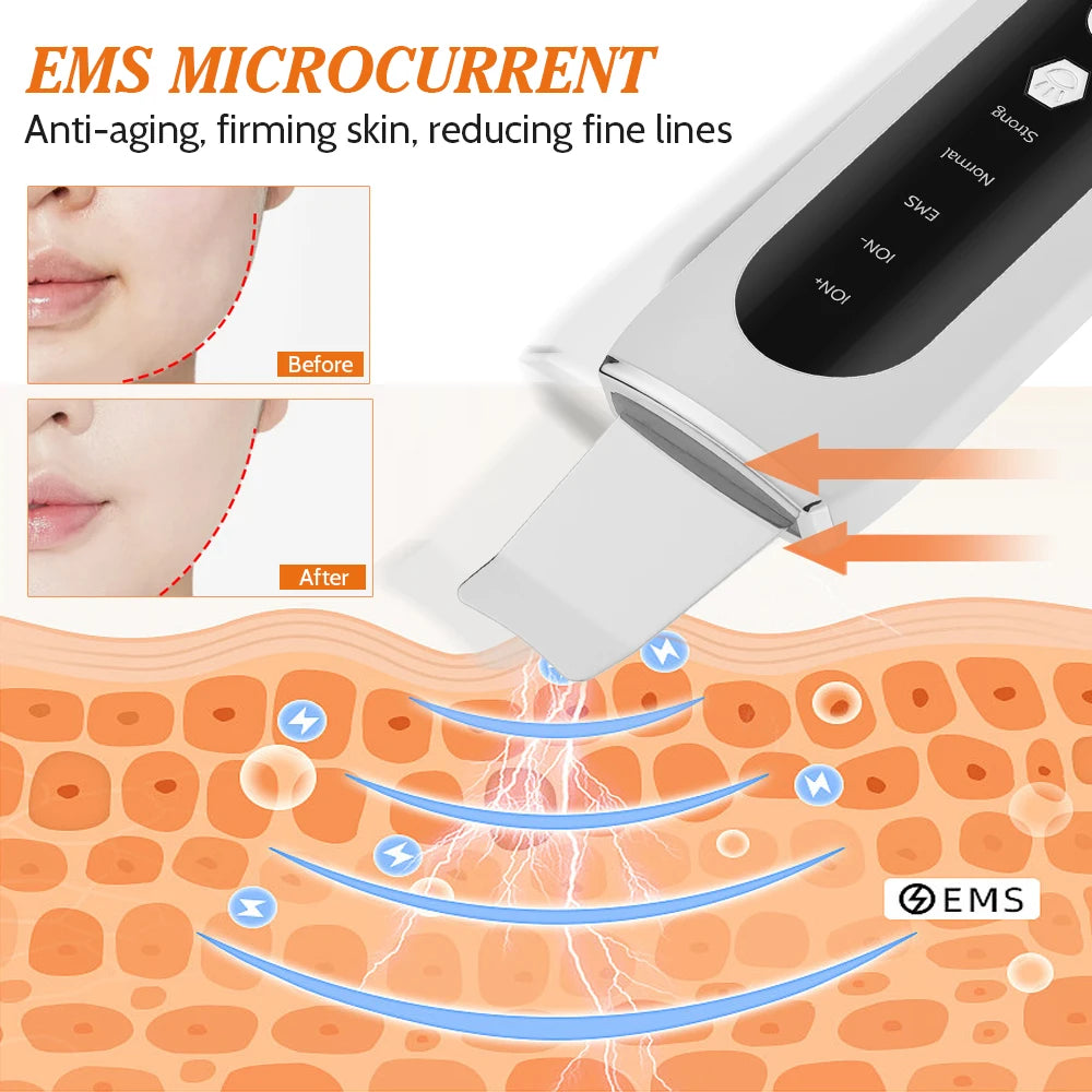 Electric Scraping Machine Scraping Instrument 5-speed Adjustment Removing Black Corners Cleaning Pores Imported Beauty Equipment